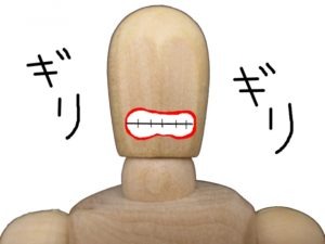 食いしばり