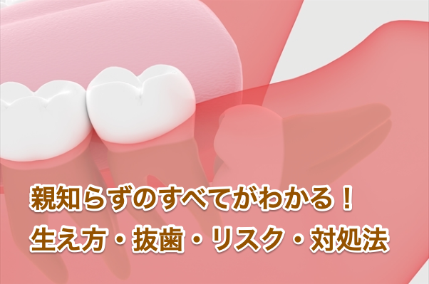親知らずのすべてがわかる！生え方・抜歯・リスク・対処法
